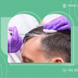 Prp Hair Therapy  Treatment Cost in Bangalore at ANEW