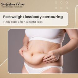 Surgery After Weight Loss