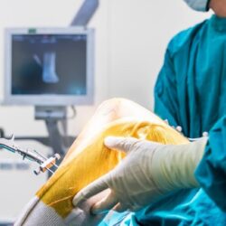 knee replacement surgeons adelaide